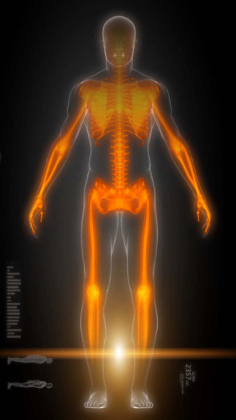 Escaneamento de bioimpedância mostrando corpo humano com sistema muscular e esquelético destacado em laranja durante análise de composição corporal