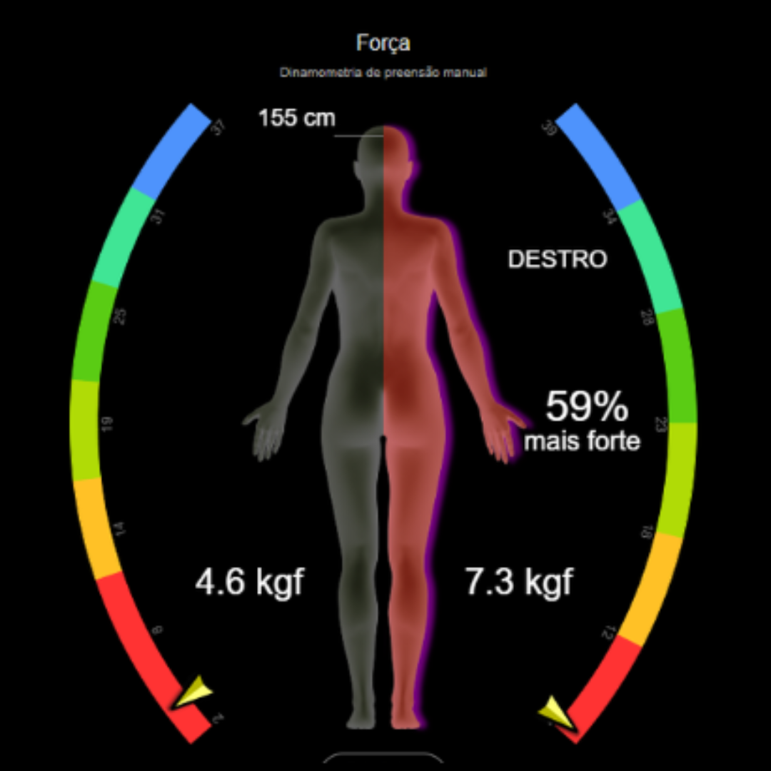 Exame de bioimpedância mostrando análise de composição corporal com comparação de massa muscular e gordura corporal antes e depois do tratamento metabólico